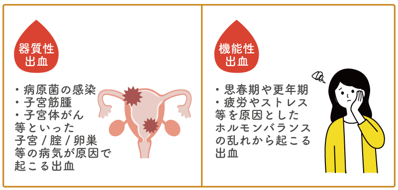 不正出血は原因と種類が異なる