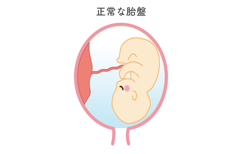 正常な胎盤のイメージ図