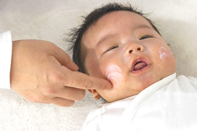 保湿剤を顔に塗られている赤ちゃん