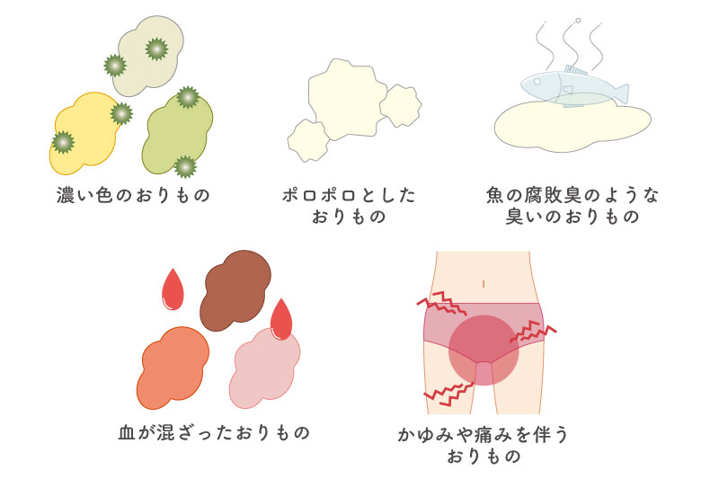 おりものの異常、帯下異常